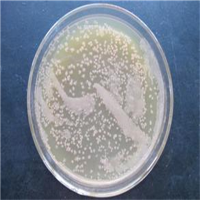 Lecanicillium aranearum (Petch) Zare & W. Gams